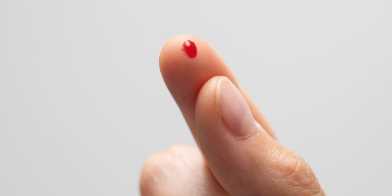 Giới thiệu từng giấc mơ thấy máu 12BET